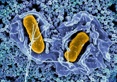 Colorized scanning electron micrograph of Salmonella bacteria in intestinal tissue